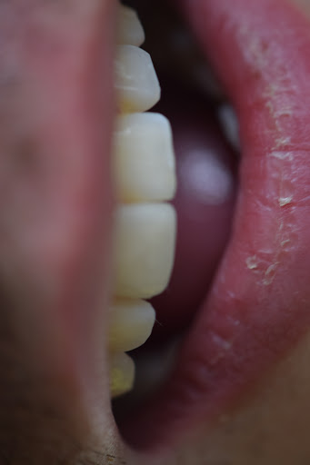 Clínica Dental Chipilo